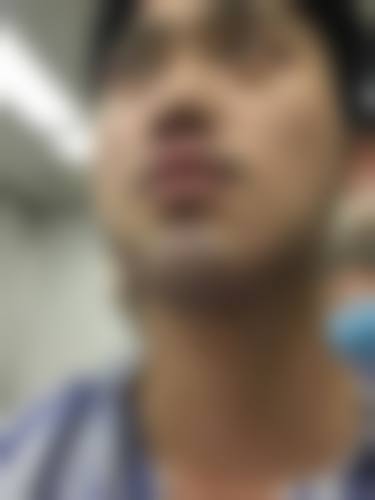 上海第九人民医院——上海市更好的种植头发医院