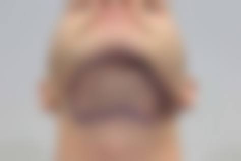 上海种头发哪里做的好医院预约挂号攻略