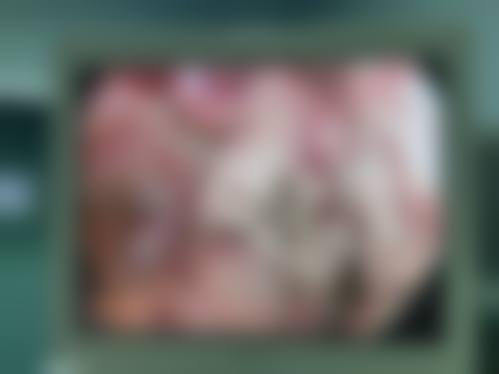 四、北京注射物取出收费情况