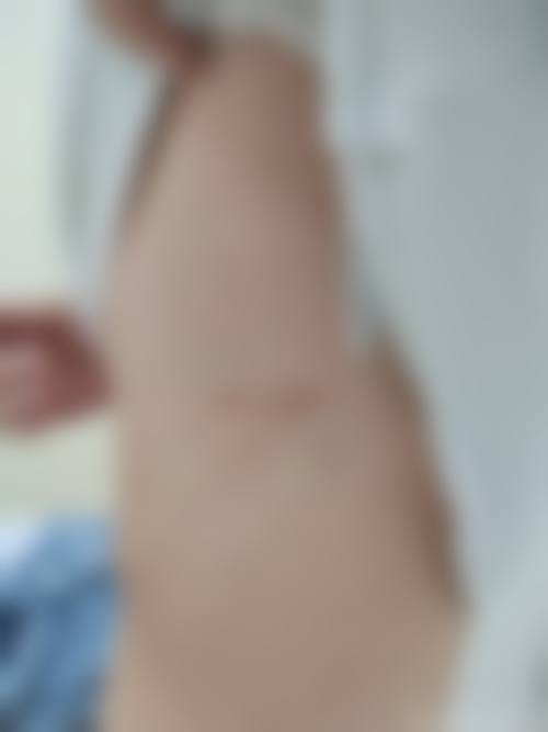 九、围绕抓伤白色疤痕怎么变回肉色,临床中更常见的并发问题有哪些?