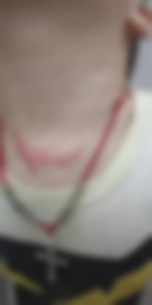 武汉手术疤痕修复收费价格表2026 协和同济激光修复1100元起 疤痕淡化90%武汉伢都说好