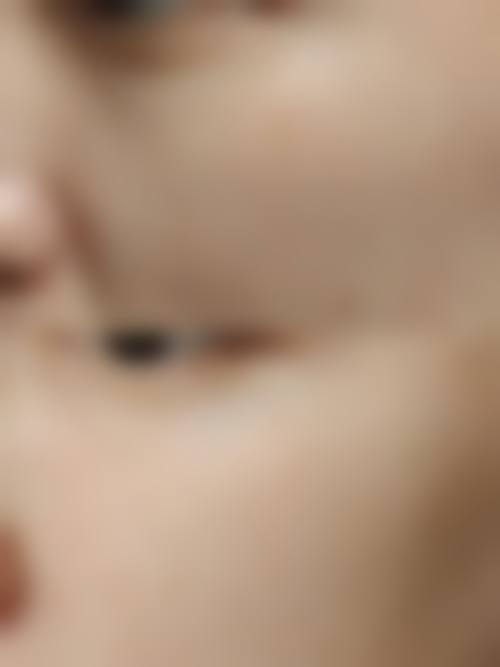 郑州玻尿酸打卧蚕哪里打的好？贺洁、王杨医生技术绝了，东方整形和美莱整形闭眼冲！