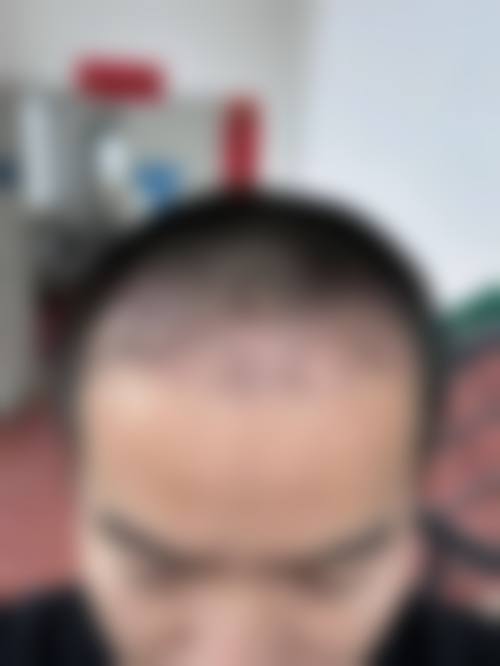 武汉五洲整形医院口碑实例怎么样?