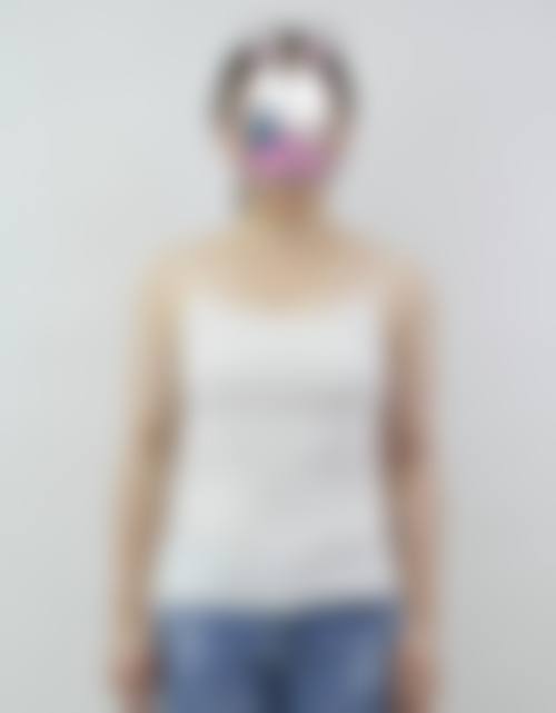 四、整形项目热门问题解答及在线询问