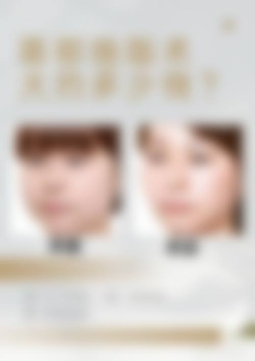 广州做颧骨手术更好的医院——广州紫馨整形外科医院