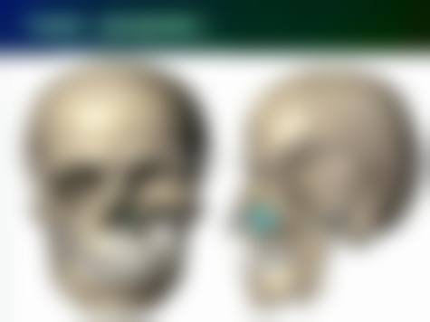 广州看颧骨高哪家医院好选择指南