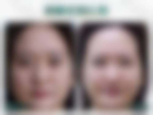 深圳艺星医疗美容医院地址电话：位于福田深南中路3024号，电话0755 - 82***，是正规靠谱医院！ 