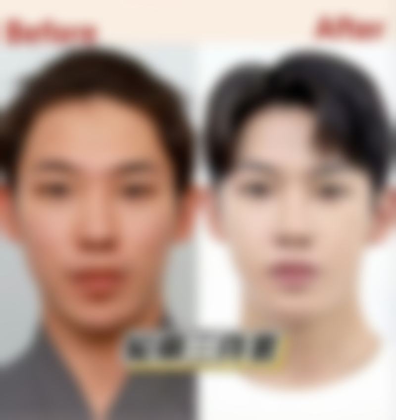 六、想知道甘肃省人民医院整容好吗?看这些真实细节!