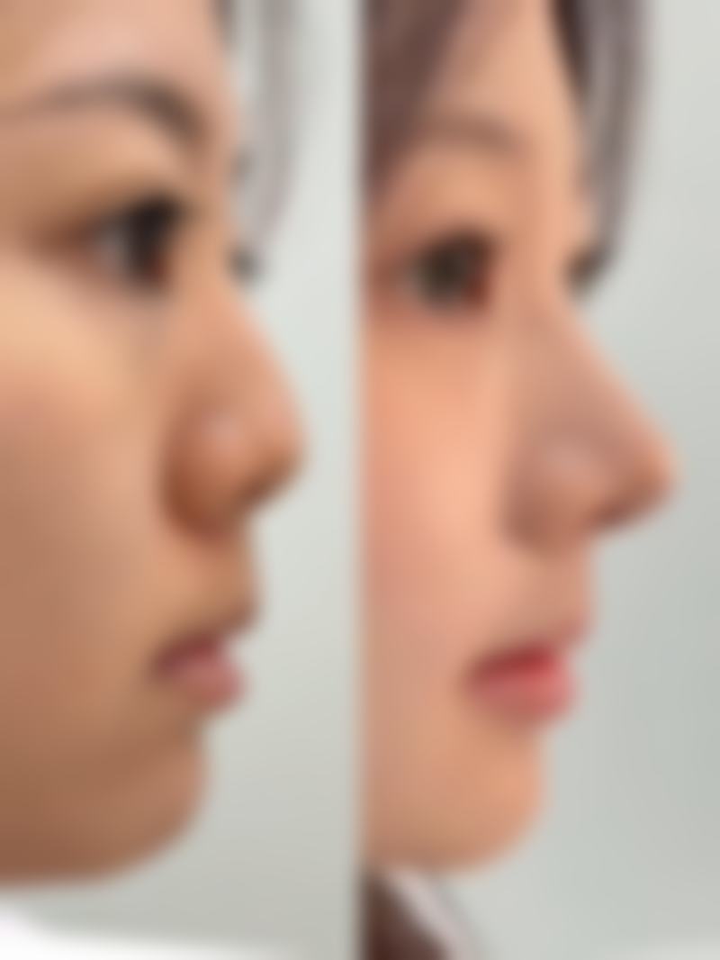 四、除了眼鼻，天鑫还有哪些宝藏项目？皮肤抗衰与轮廓固定揭秘