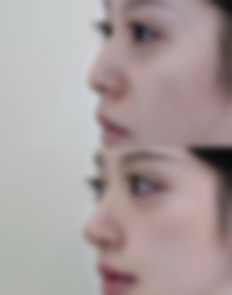 六、哪些人适合选择杭州天鑫医美？对号入座看看有没有你