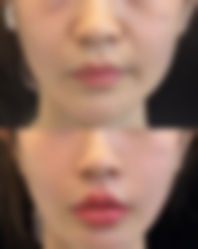 除了地铁，沈阳北方整形外科医院还有哪些交通方式？