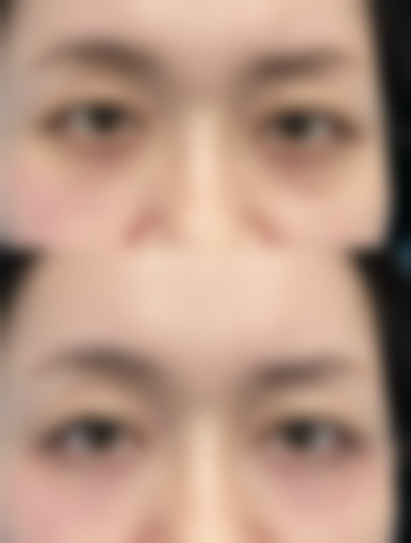 七、真人实例见证：上海华美医疗美容医院的变得更美实力