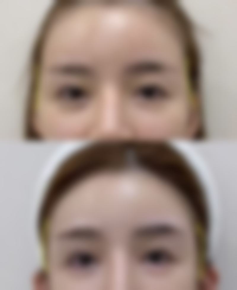 九、真人实例分享:在上海九院变得更美是怎样的体验?