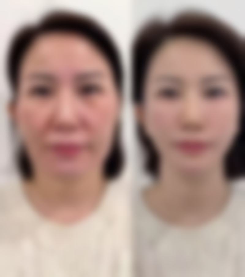 甘肃省人民医院(整形外科)24小时人工服务：电话(0931)8281***，地址东岗西路204号，做双眼皮、疤痕修复找省内最早整形科！