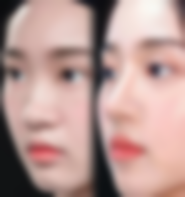 成都打玻尿酸医院哪家好？美莱、画美、铜雀台靠谱，口碑医生加持