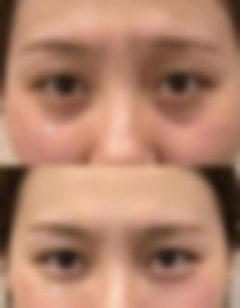 上海打紧缩针哪家好