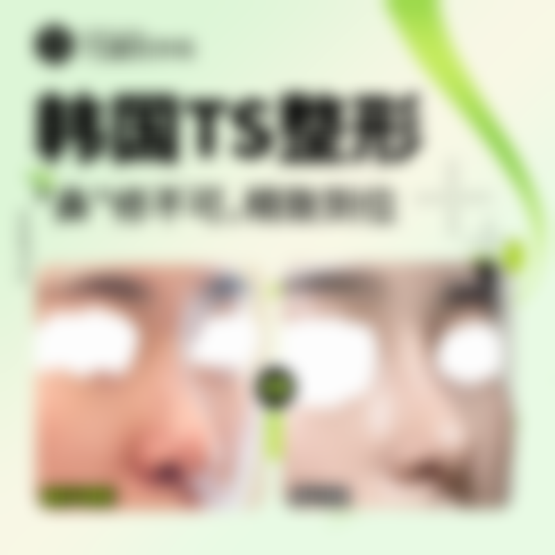 3. 鼻部整形 - 姿挺原生鼻综合（5200元起步）