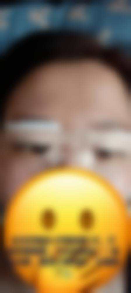 无痕双眼皮哪些人群适合,哪些情况不建议选择?