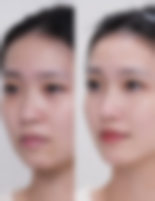 常见这些方法“成效不明显”的真实原因有哪些