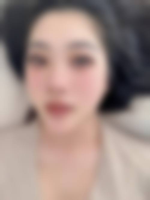 从伤害大小对比,双眼皮和切眉哪个简单安心?