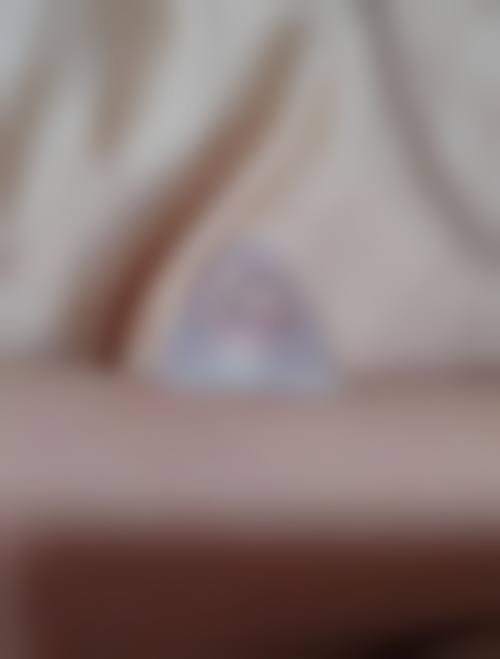 取出隆胸假体的技术优势