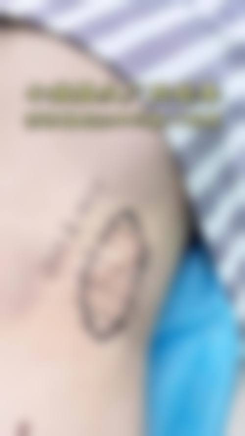 哪些医院医生擅长修复疤痕增生