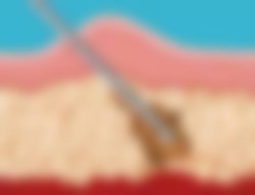 二、郑金满医生擅长哪些项目