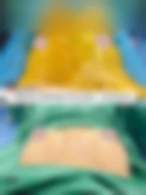 假体隆胸是什么？通常在什么医学背景下被选择？