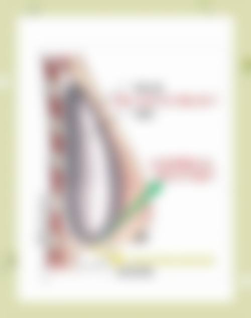 隆胸方法的常见认知偏差与误解