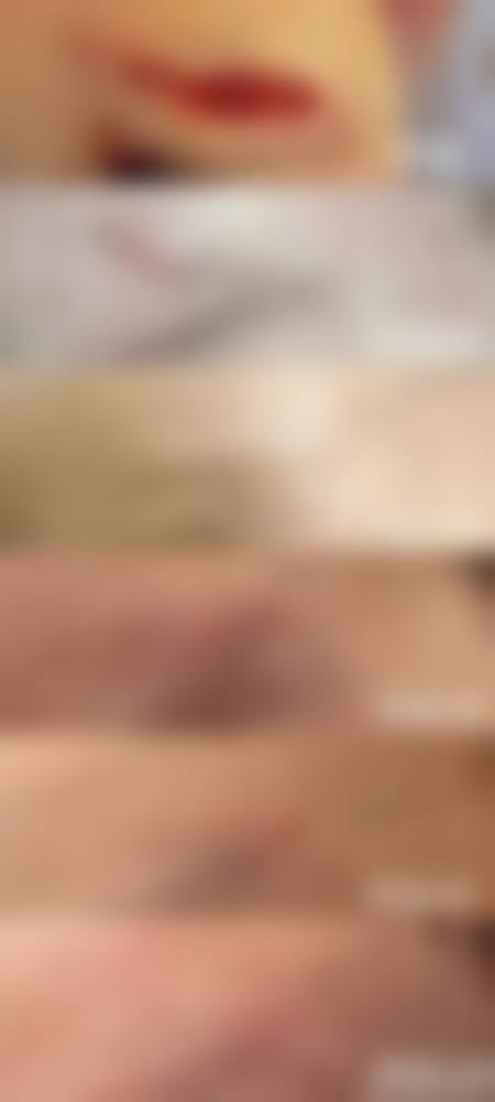 激光治疗皮肤愈合后的黑色疤痕常见并发症及发生概率