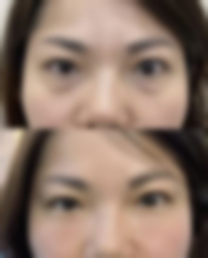 {梁青松做双眼皮怎么样？6D灵动双眼皮自然无痕，乌鲁木齐口碑前三医生亲诊，价格8800起！  

【解析】  
1. 标题前半段保持