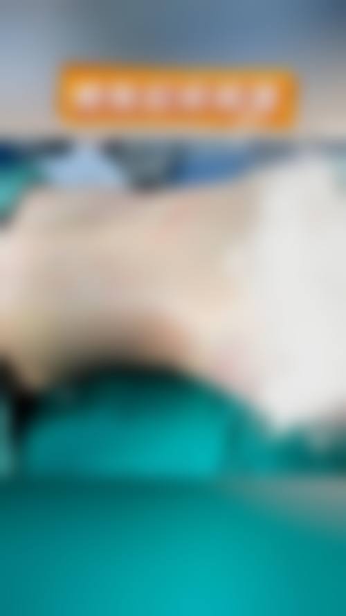 哪些情况通常不被认为是合适指征