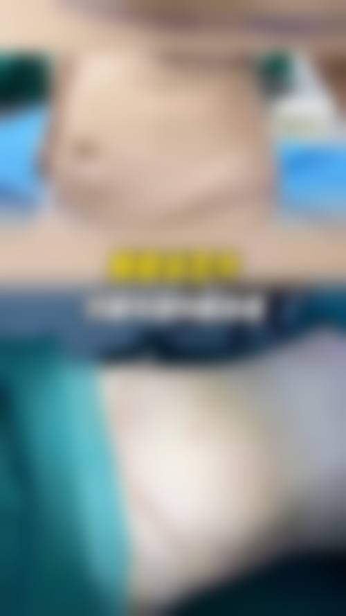 关于抽脂手术危险大吗知乎上的看法——大众声音