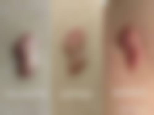 昆明杰西艾整形外科医院预约挂号