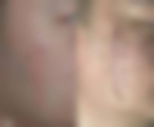 三、徐州中美强华整形美容医院开展项目及特色技术