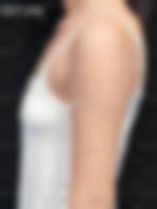 长期成效维护，让怎样隆胸才能有效更长久