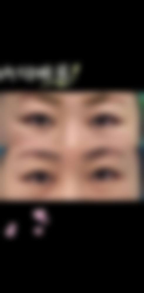 热敷眼袋要多长时间合适