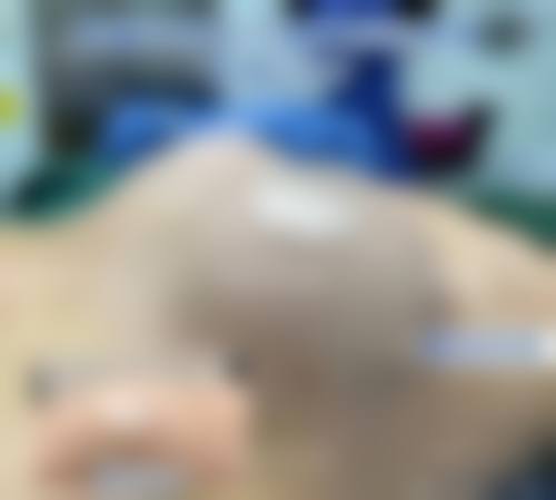 {怎样隆胸才能有效又不伤身体？选假体/自体脂肪，2-10万安全塑美胸