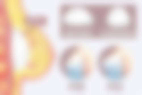 术前精细评估，是怎样隆胸才能有效的重要环节