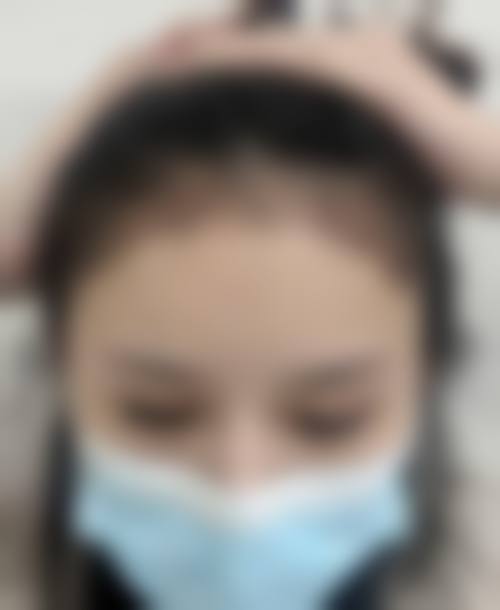 三、苏州爱思特整形医院开展项目及特色技术