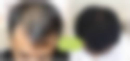 八、患者常见问题解答（精选 ）