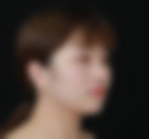 硅胶隆鼻的成效稳定性与哪些条件直接相关