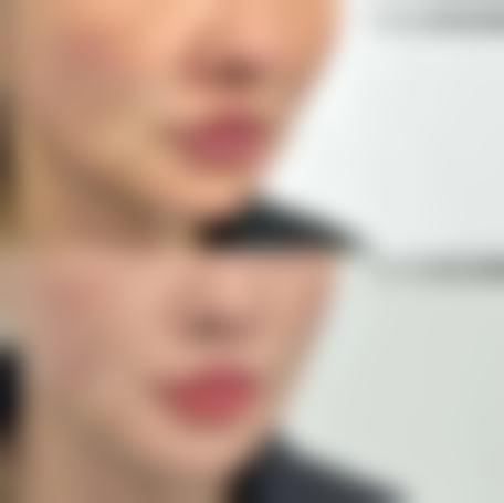 九、苏州爱思特整形医院口碑好不好？患者诊室评价：