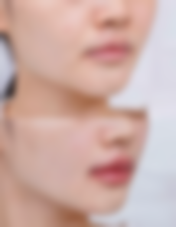 隆鼻后打玻尿酸该选哪些医院和医生?