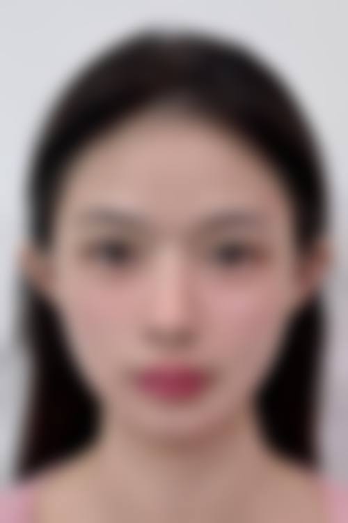 十一、在决定眼袋下面凹陷怎么修复饱满前，普通用户更容易忽略的关键信息