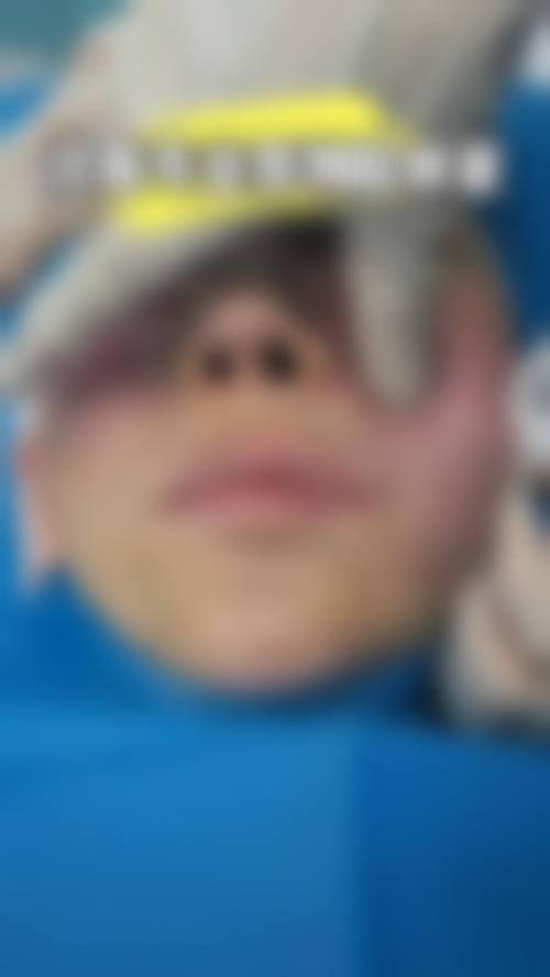 9、患者常见问题解答（精选 ）