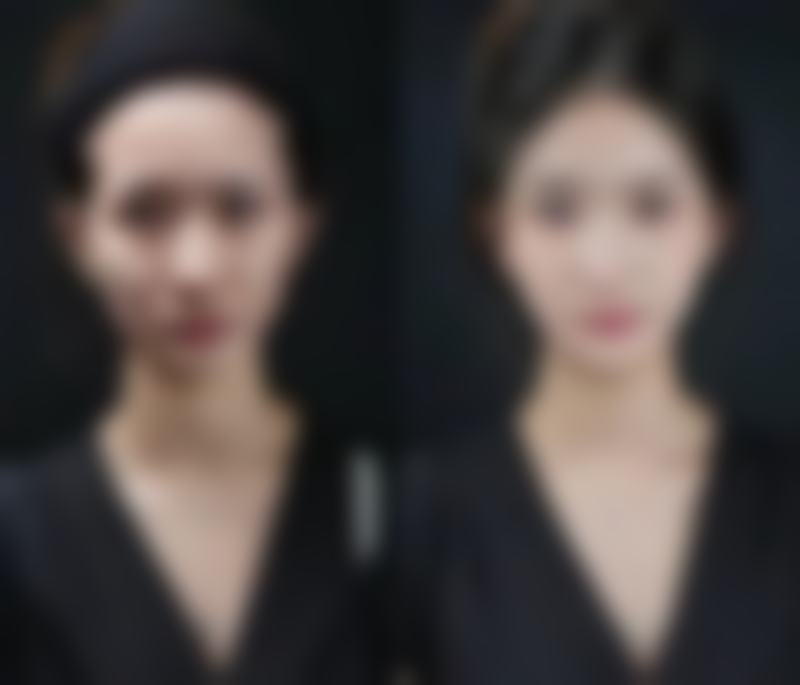 韩国陈整形外科医院正规靠谱吗？