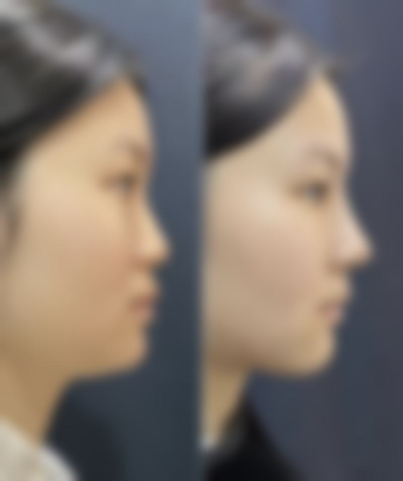 韩国陈整形外科医院温馨提示——为了节省您的时间，看诊前请预约哦！