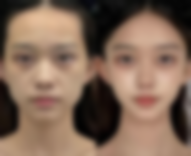 韩国陈整形外科医院价格表/收费价格一览表