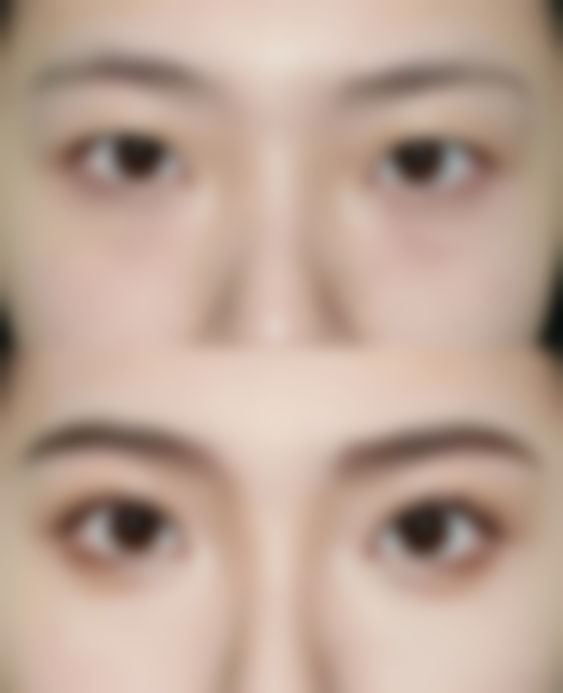 韩国陈整形外科医院诊疗项目